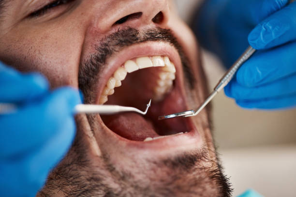 Best Pediatric Emergency Dentist in Strasburg, VA
